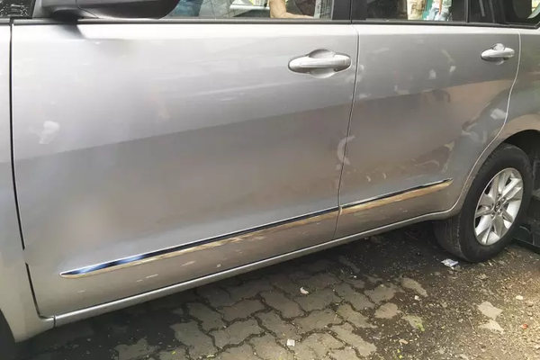 Phụ kiện ốp sườn xe