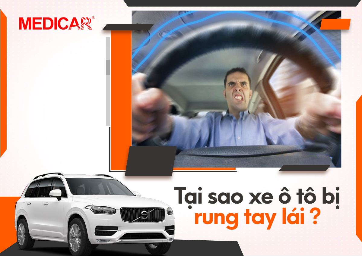 Hình ảnh minh họa tay lái xe ô tô bị rung